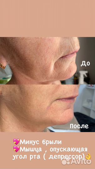 Массаж лица и тела