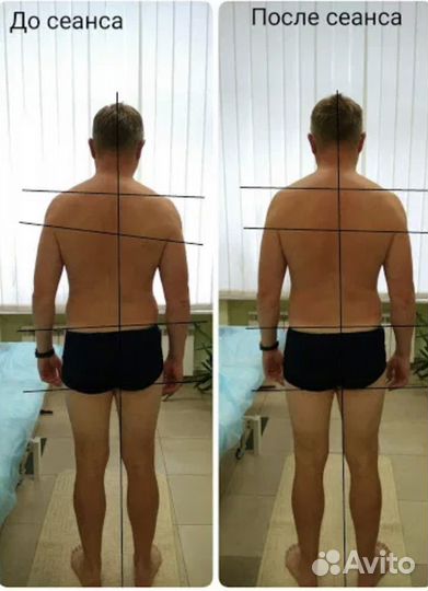 Костоправ,Мануальный терапевт,Висцеральный массаж