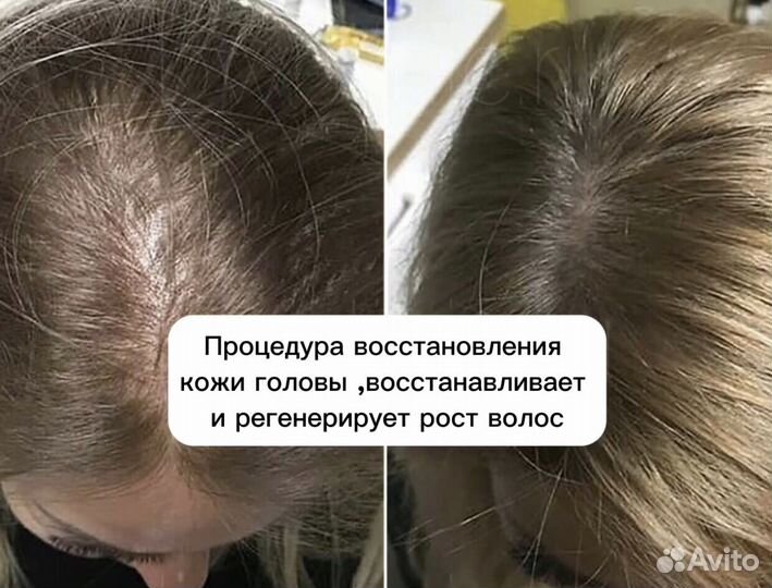 Восстановление волос,лечение волос