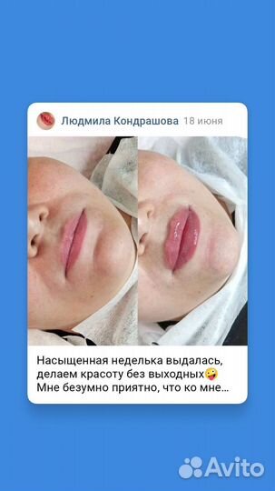Услуги косметолога