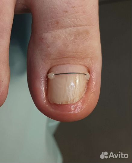 Подолог,медицинский педикюр, маникюр, SMART