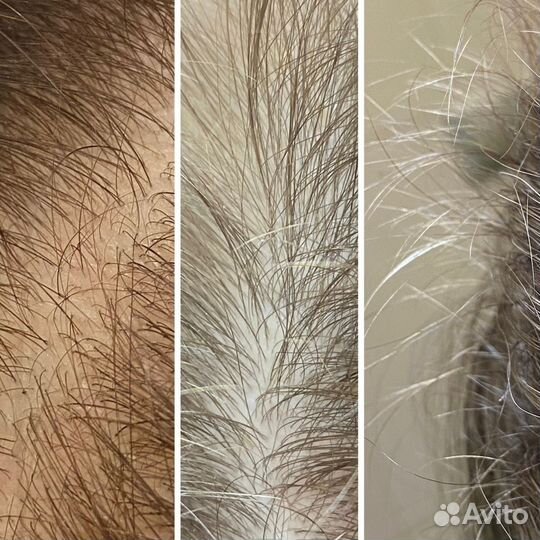 Шампунь /сыворотка для активного роста волос