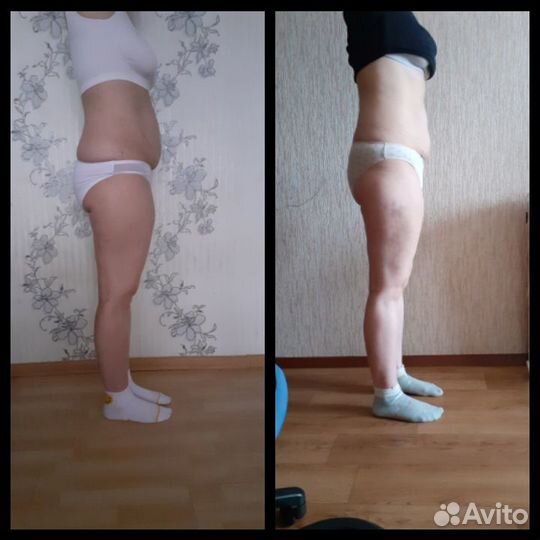 Массаж Антицеллюлитный