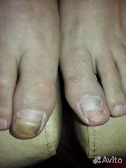 Медицинский педикюр, услуги подолога выезд на дом