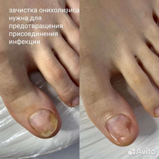 Педикюр с выездом на дом