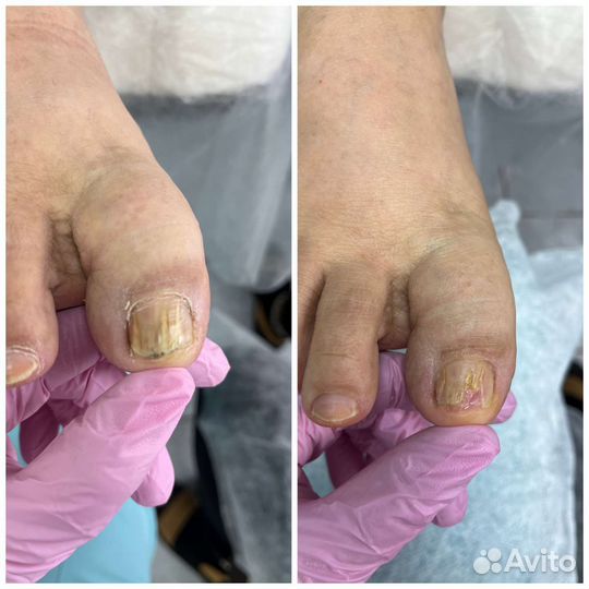 Маникюр педикюр