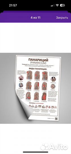 Новые плакаты подолога