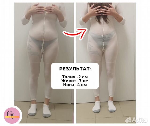 Аппаратный массаж