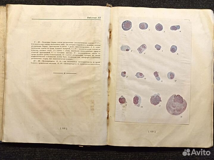 Атлас клинической гематологии. Стражеско. 1940