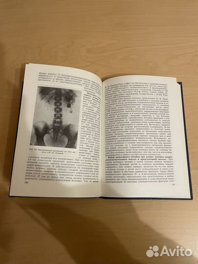 Уролитиаз: Тиктинский Олег Леонидович 1980