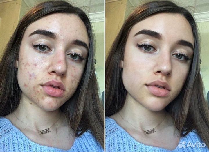 Срочная ретушь