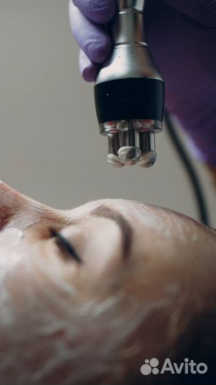 Rf лифтинг,Уз кавитация