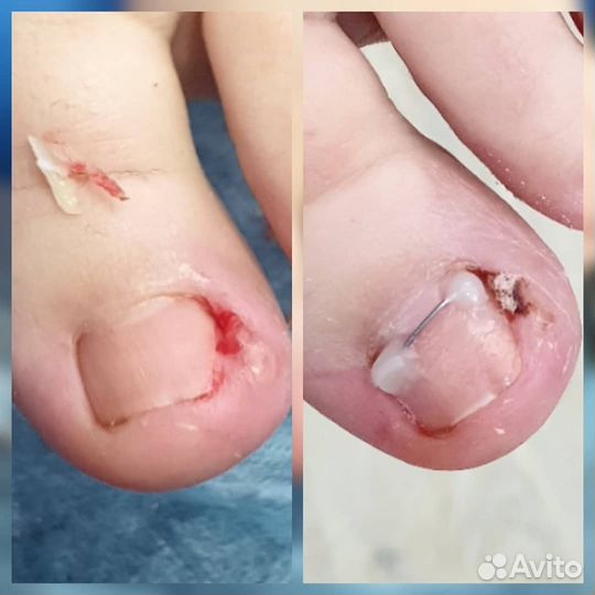 Педикюр. Подология. Ортониксия