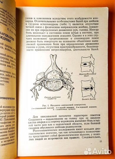 А. И.,Воробьев, Т.В. Шишкова Кардиалгии