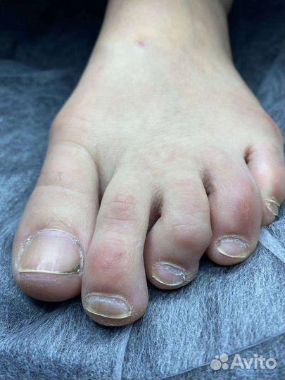 Аппаратный педикюр