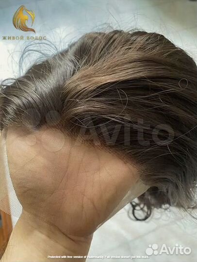 Парик система замещения на сетке