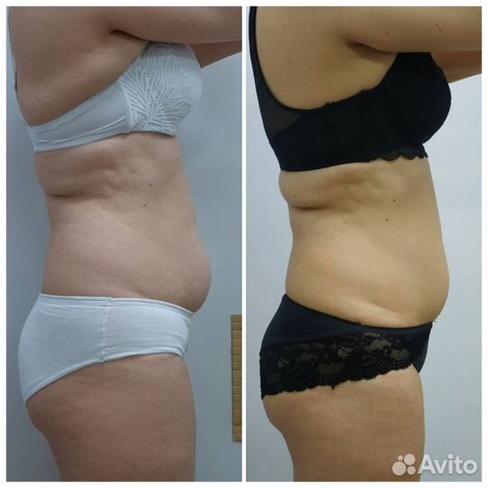 Массаж похудение