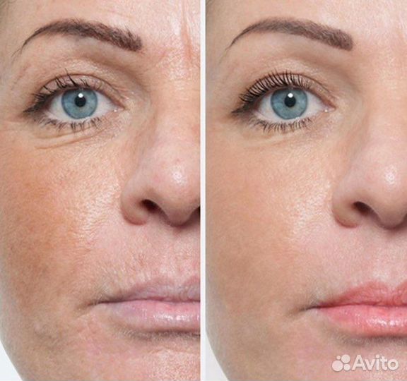 Массаж лица скульптурирующий