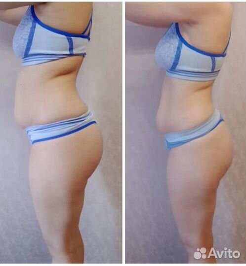 Аппаратный массаж