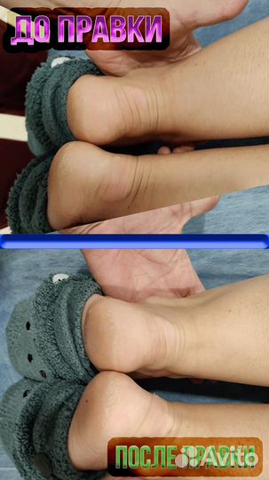 Костоправ Владимир Лой (г.Москва, ЮВАО, Люблино)