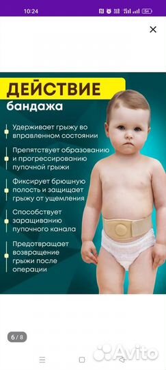 Бандаж при пупочной грыже