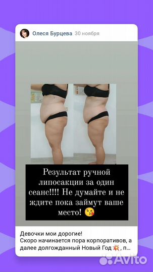 Антицеллюлитный массаж ручной