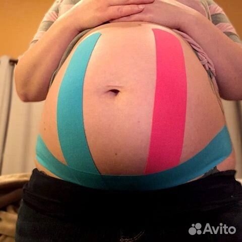 Тейпирование