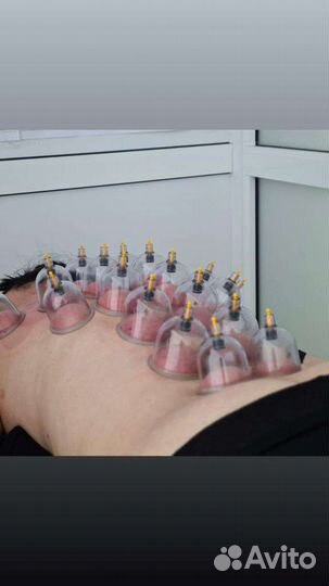 Ударно-динамический массаж, банки