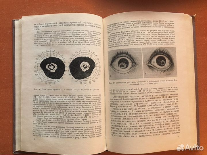 Книги по офтальмологии СССР