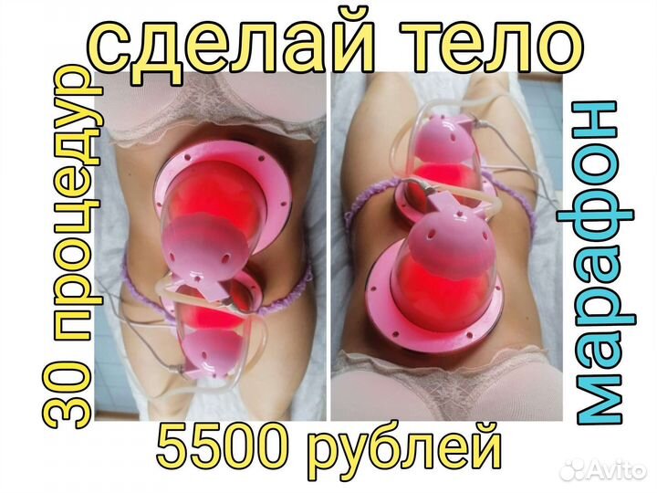 Вакуумный массаж. Коррекция фигуры. Похудение