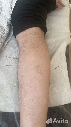 Антицеллюлитный массаж