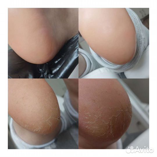 Маникюр и педикюр, наращивание ногтей