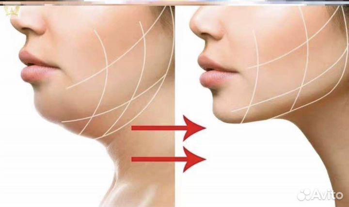 Мяч для образования скул