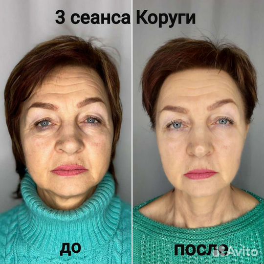 Массаж лица Коруги и массаж тела