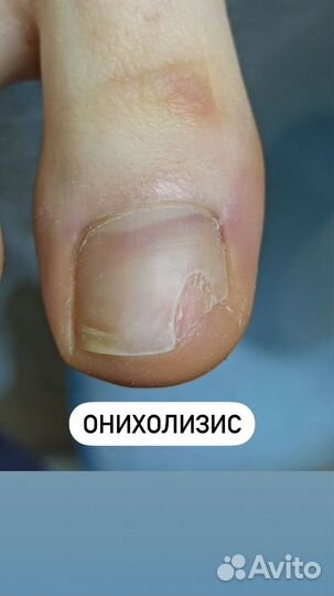 Курсы подологии