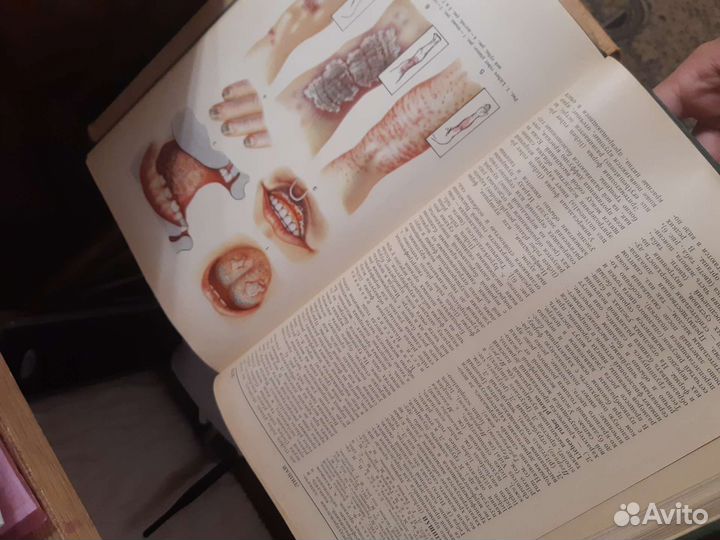 Малая медицинская энциклопедия