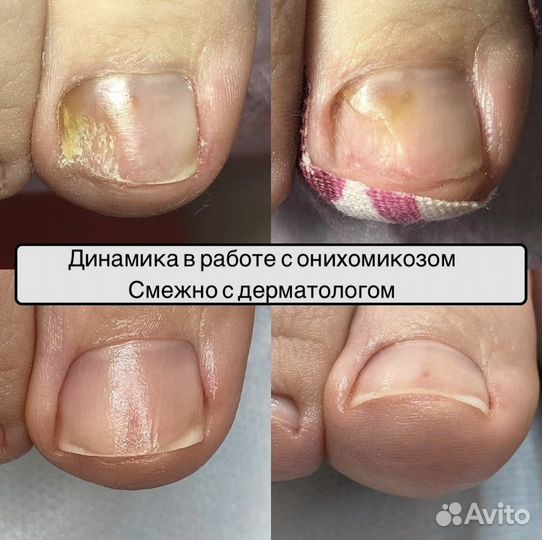 Подолог. Воронеж