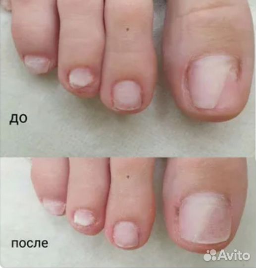 Маникюр педикюр на дому