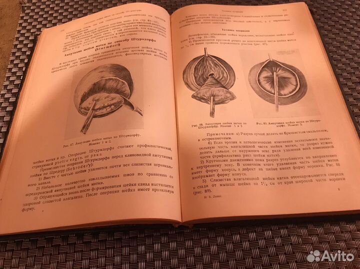 Техника Гинекологических операций Левит 1938