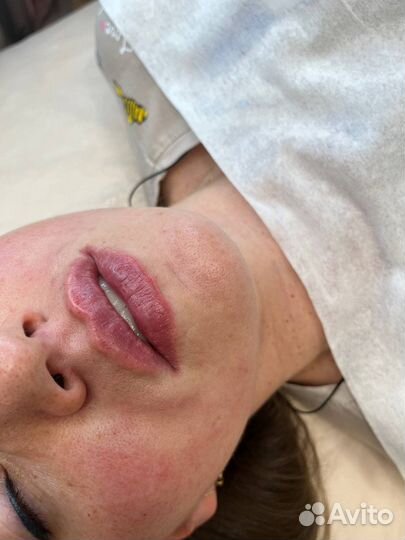 Врач - косметолог