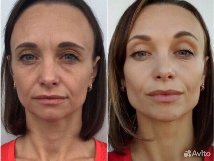 Скульптурный массаж лица до и после