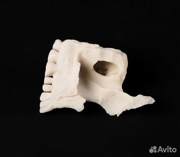 Анатомический макет верхней челюсти