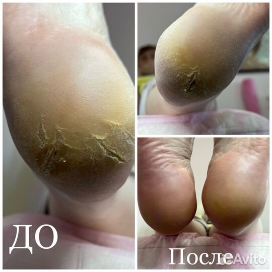 Маникюр педикюр наращивание ногтей выезд на дом