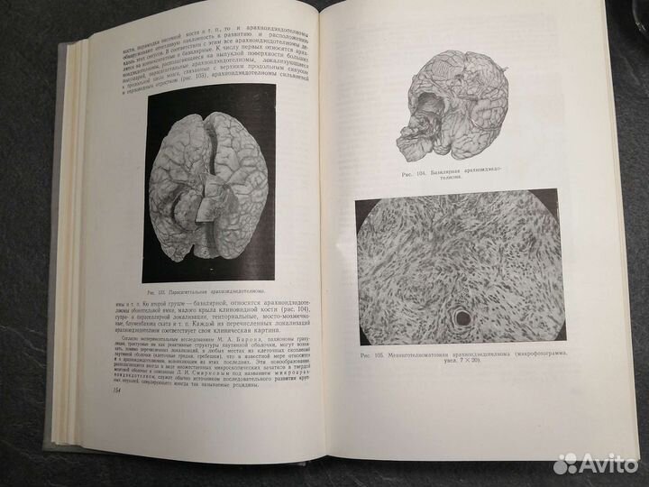 Злокачественные опухоли
