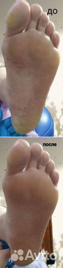 Маникюр, педикюр