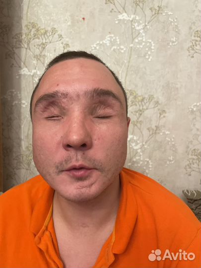 Рандомная работа инвалид первой группы по зрению