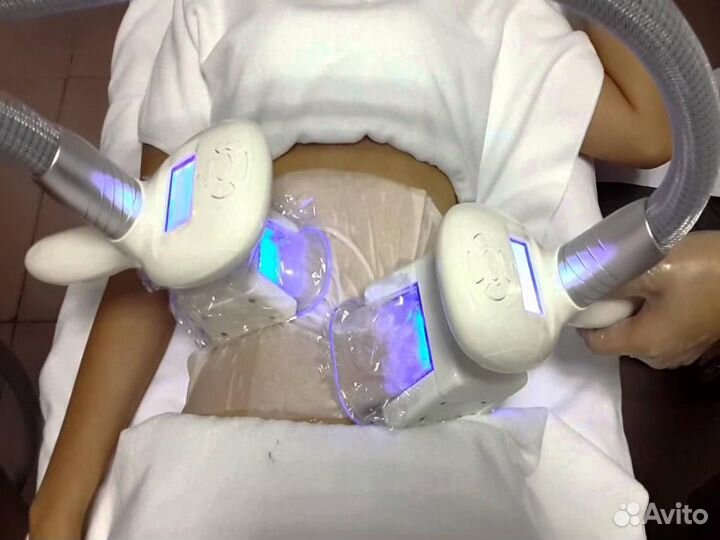 Модель на криолиполиз