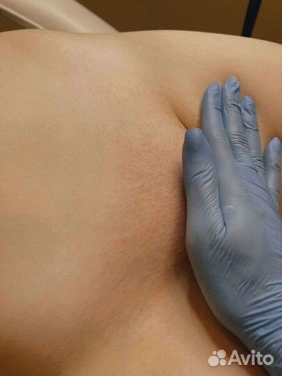 Шугаринг (Мастер Сахарной Депиляции)