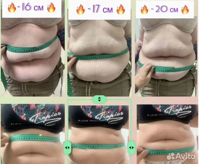 Удаление жира,вибромассаж, миостимуляция