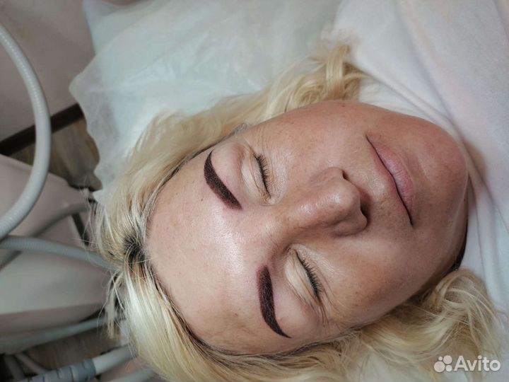 Перманентный макияж (татуаж) Удаление татуажа